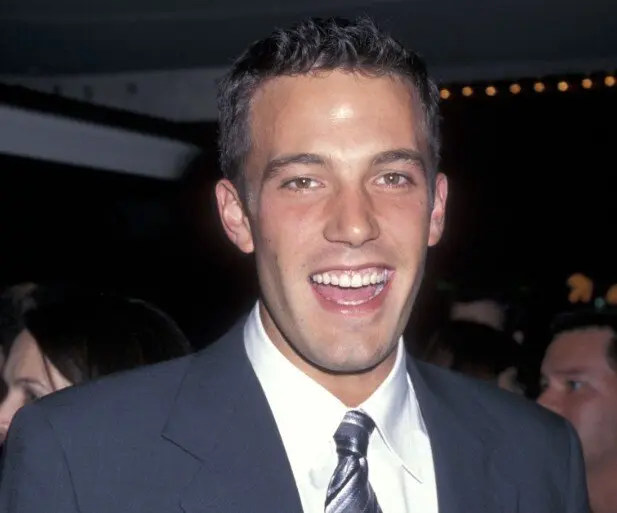 Ben Affleck before dental work
